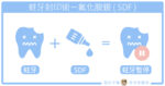SDF 氟化氨銀