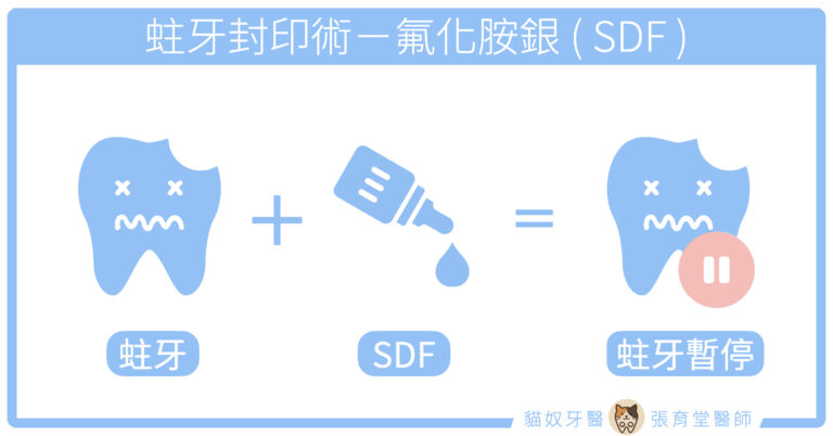 SDF 氟化氨銀